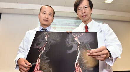 Radiotherapy to Head and Neck Raises Risk for Stroke CUHK Proved Effectiveness of Carotid Angioplasty and Stenting