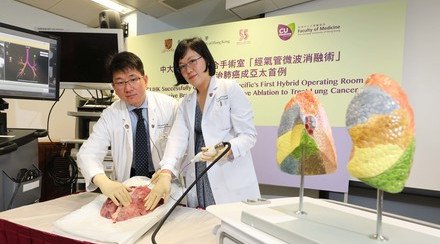 CUHK Successfully Conducts Asia-Pacific’s First Hybrid Operating Room Non-invasive Bronchoscopic Microwave Ablation to Treat Lung Cancer