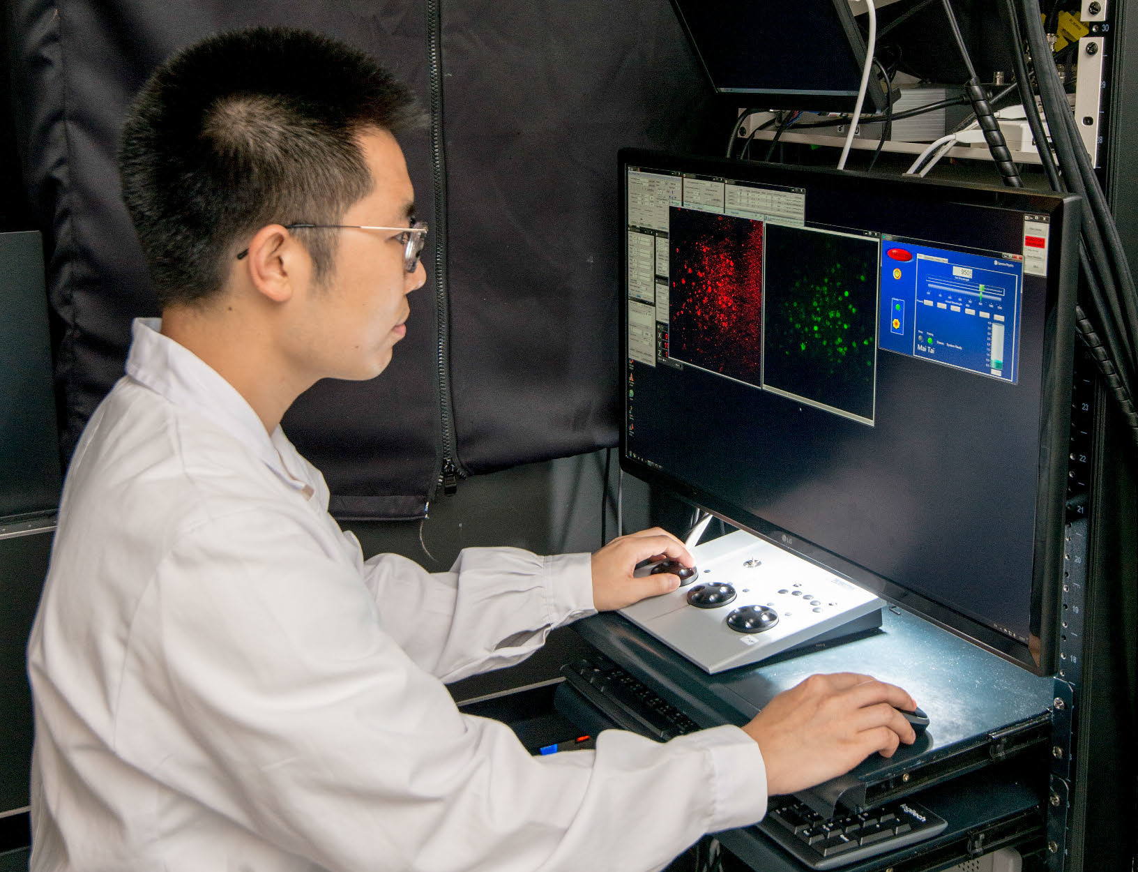 中大醫學院建造了全港首部針對腦小血管病病理研究而特製的「活體多光子顯微鏡」，了解相關發病機制，對將來發展可延緩病程的治療方法尤其重要。