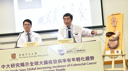 CUHK Study Sees Increasing Global Incidence of Colorectal Cancer Among Younger People