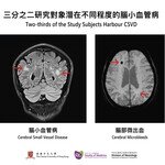 CUHK celebrates World Brain Day 2022  Calls for prevention of cerebral small vessel disease to lower the risks of stroke and cognitive impairment