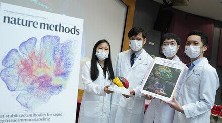 CUHK’s Margaret K.L. Cheung Research Centre for Management of Parkinsonism develops  a new tissue imaging technique for studying brain diseases