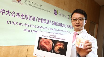CUHK World’s First Study Sets a New Direction on Aspirin Use after Lower Gastrointestinal Hemorrhage