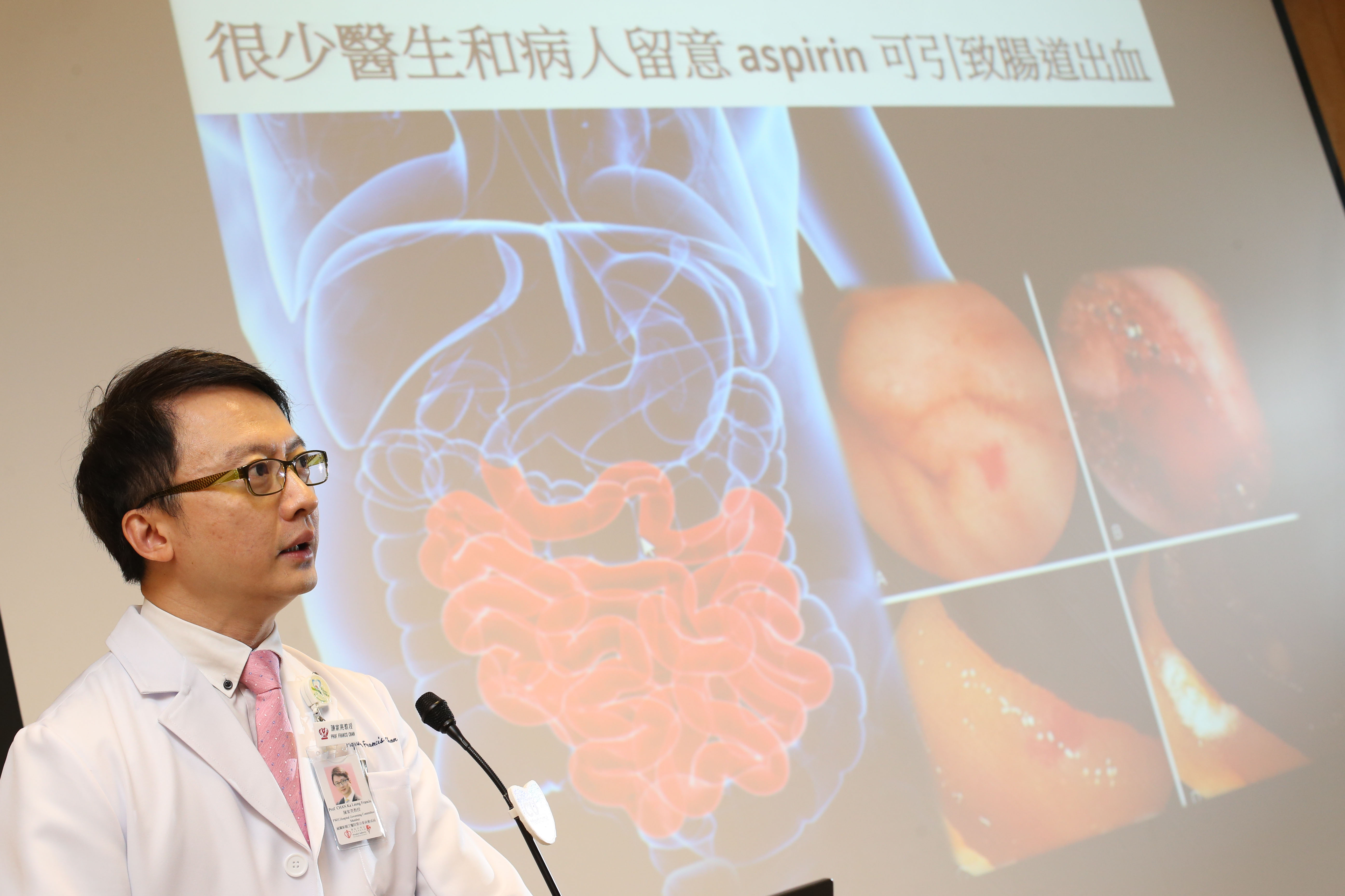 Prof. Francis CHAN states that the side effects of aspirin in the stomach are well established but few doctors and patients are aware of the fact that aspirin also causes bleeding from the lower gastrointestinal tract.