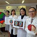 CUHK Sets up the Global First Research Registry on Early Onset Dementia in Chinese Population
