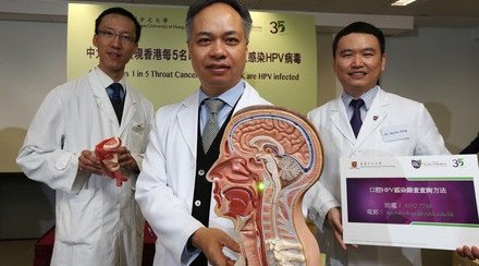 CUHK Research Shows 1 in 5 Throat Cancer Patients in HK is HPV infected