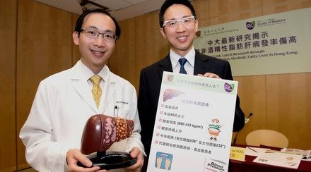 CUHK Latest Research Reveals over 100,000 New Non-alcoholic Fatty Liver Cases in Hong Kong Annually
