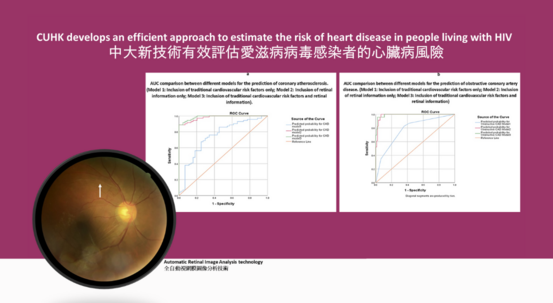 CUHK develops an efficient approach to estimate the risk of heart disease in people living with HIV