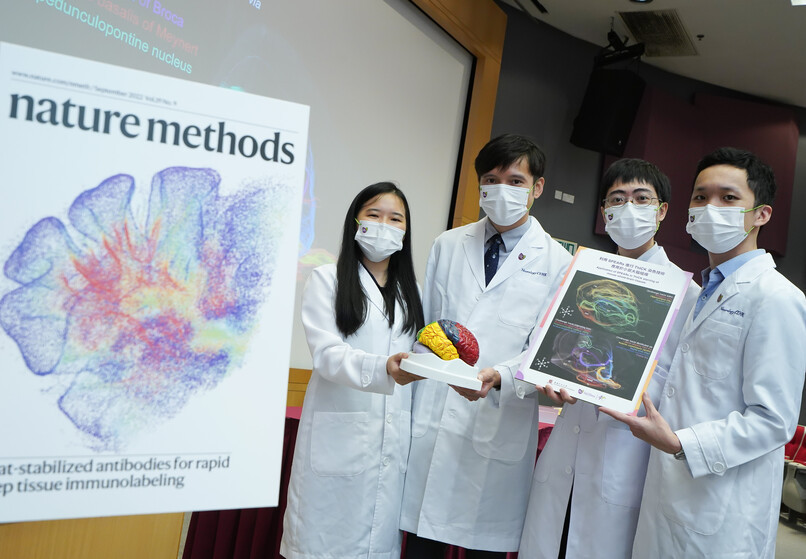CUHK’s Margaret K.L. Cheung Research Centre for Management of Parkinsonism develops a new tissue imaging technique for studying brain diseases