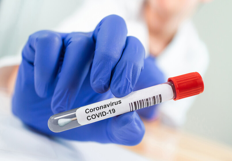 CU Medicine Offers Free Stool Screening Test for COVID-19 in Children arriving at Airport