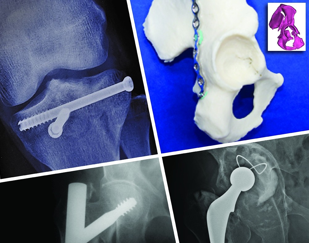 Orthopaedics and Traumatology