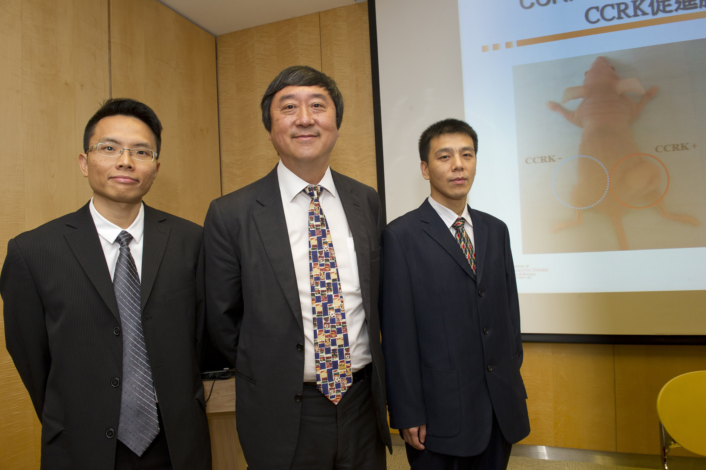 左起：郑诗乐教授、沈祖尧教授及冯海博士解开男性肝癌发病率较女性高之谜。