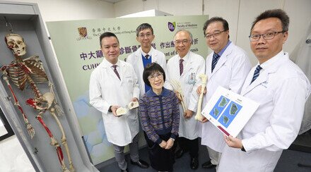 CUHK Sets Asia’s First Three-dimensional Bone Density Standard For Early Diagnosis of Osteoporosis and Fracture Prevention