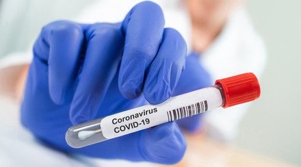 CU Medicine Offers Free Stool Screening Test for COVID-19 in Children arriving at Airport