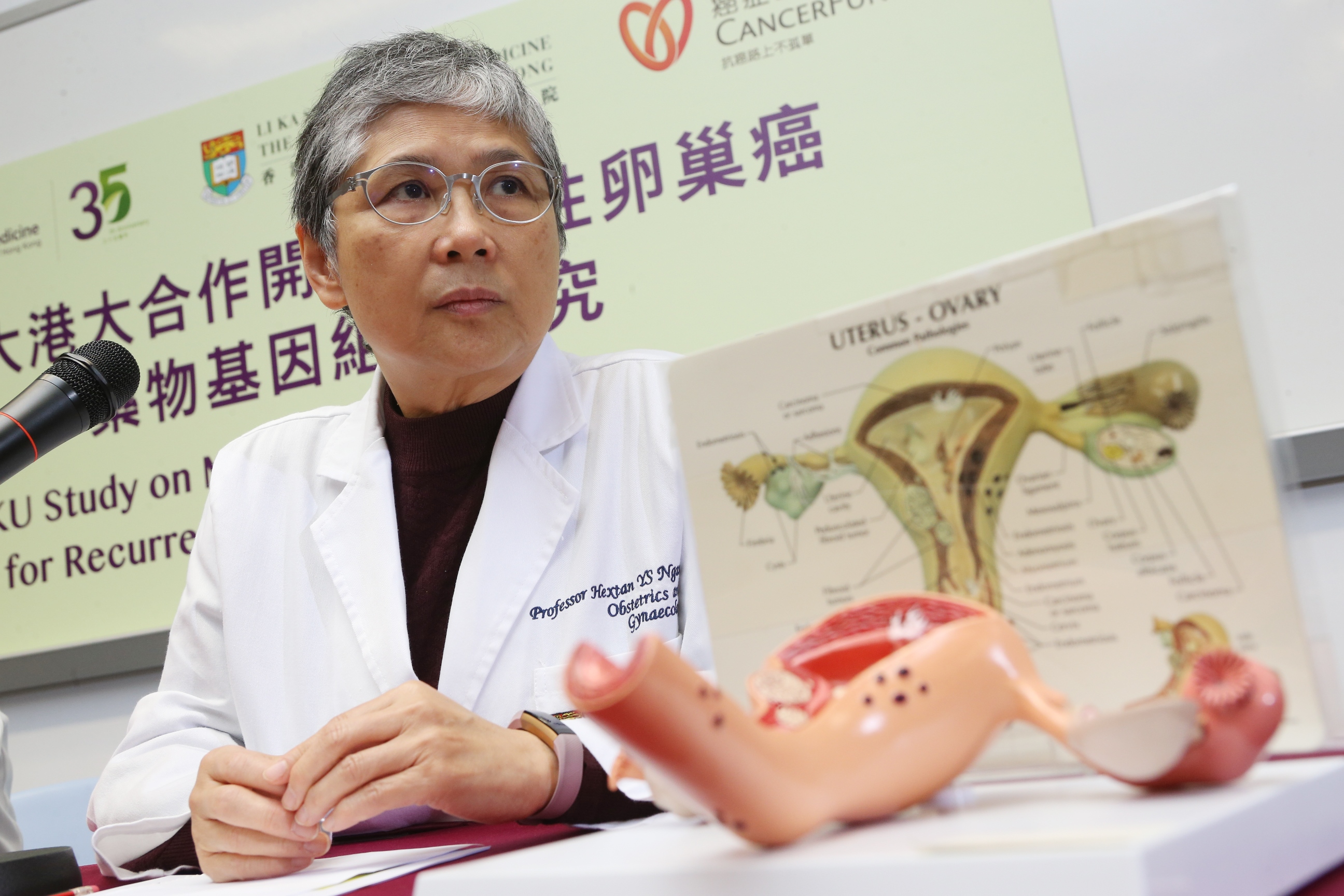 Professor NGAN says despite removal of all gross tumours, ovarian cancer recurrence would be up to 80% in late stage and therefore precise regimen is needed.