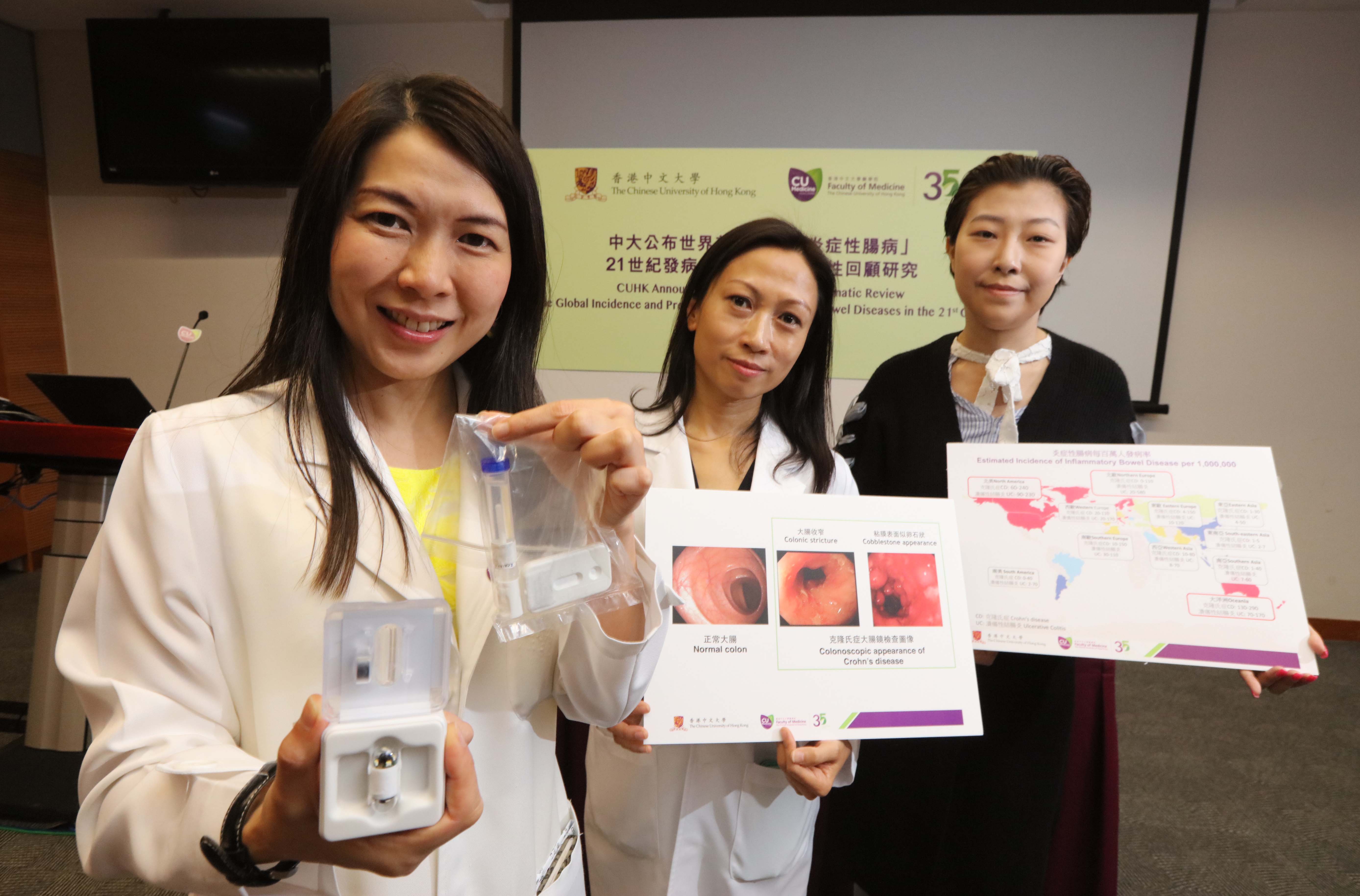The Faculty of Medicine at CUHK announces the world’s first systematic review of the global incidence and prevalence of Inflammatory Bowel Diseases (IBD) in the 21st century and found the incidence in Hong Kong having risen about 30 times in the past 30 years. Study results have just been published in the leading medical journal The Lancet. (From left) Prof. Siew NG and Chief Nursing Officer Ms Jessica CHING from the Department of Medicine and Therapeutics, Faculty of Medicine at CUHK, and the IBD patient Miss SUM. 