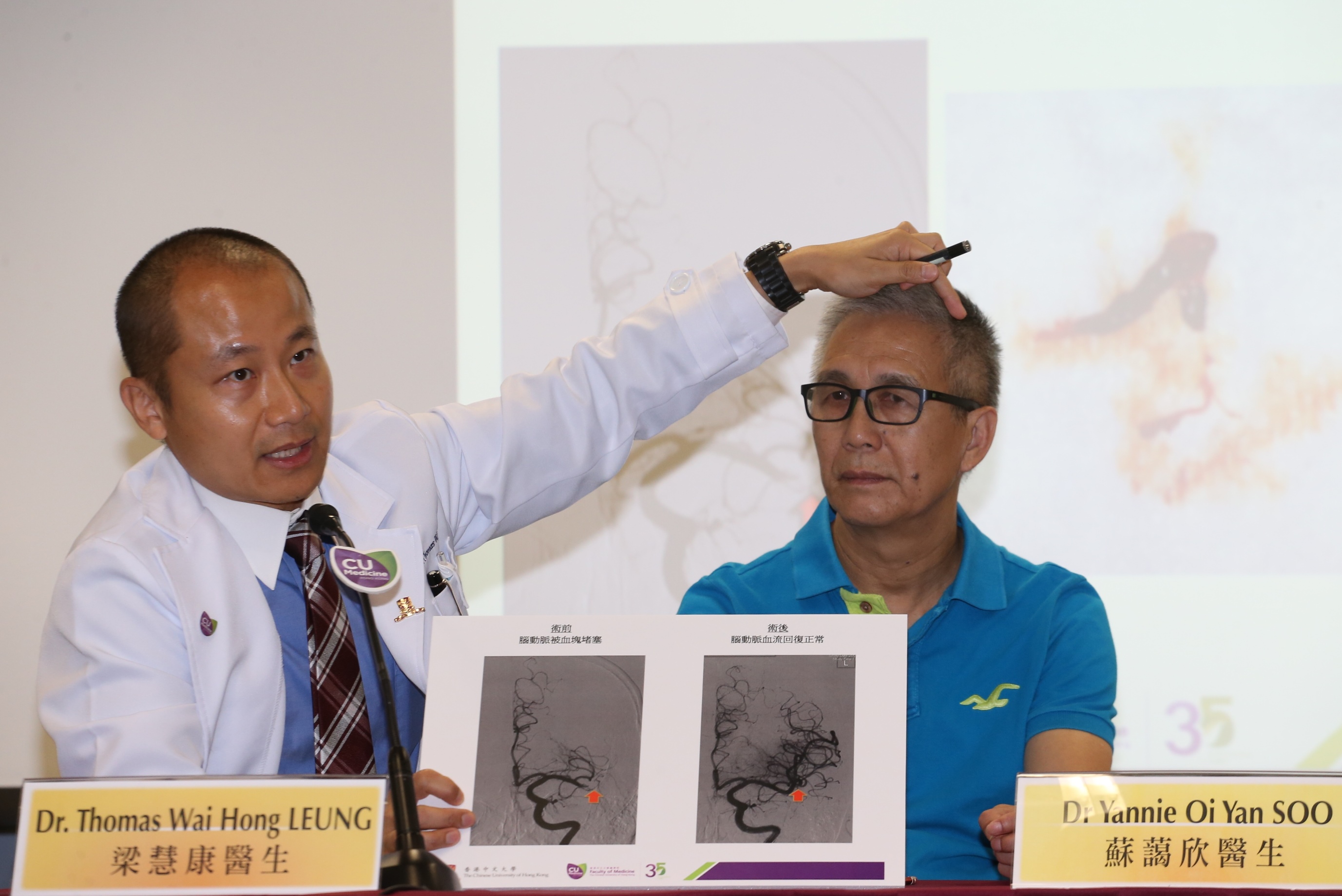 Dr Thomas LEUNG (left) explains that Mr LOK’s left cerebral artery was occluded by a blood clot several months ago when he had a stroke. His blood flow to left cerebral artery is back to normal after the blood clot was retrieved. 