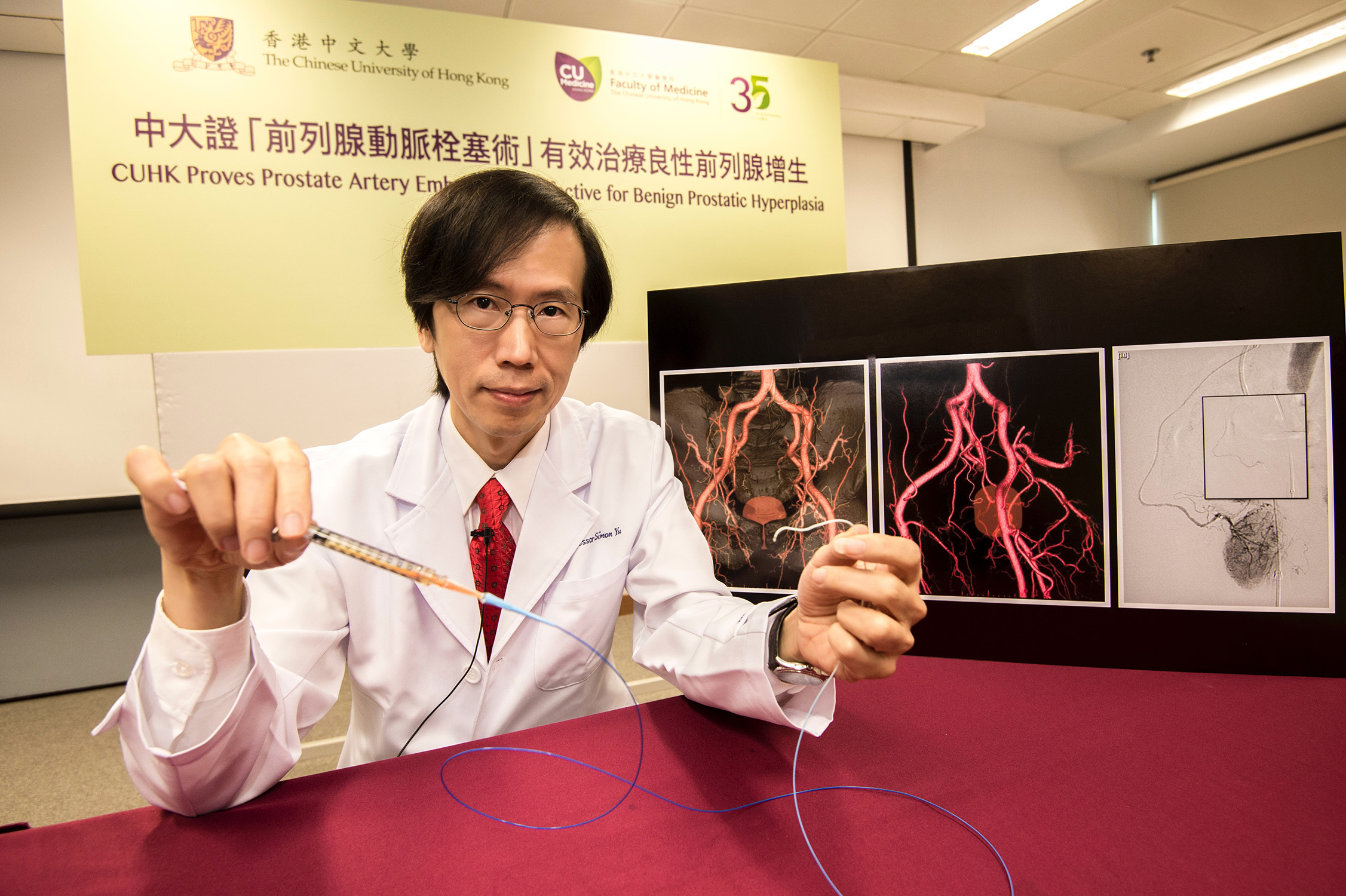 Prof. Simon YU, Chairman, Department of Imaging and Interventional Radiology, Faculty of Medicine, CUHK and Director of the Vascular and Interventional Radiology Foundation Clinical Science Centre, proves in his recent study that Prostate Artery Embolization is a highly effective treatment for Benign Prostatic Hyperplasia, with success rates of 90%.
