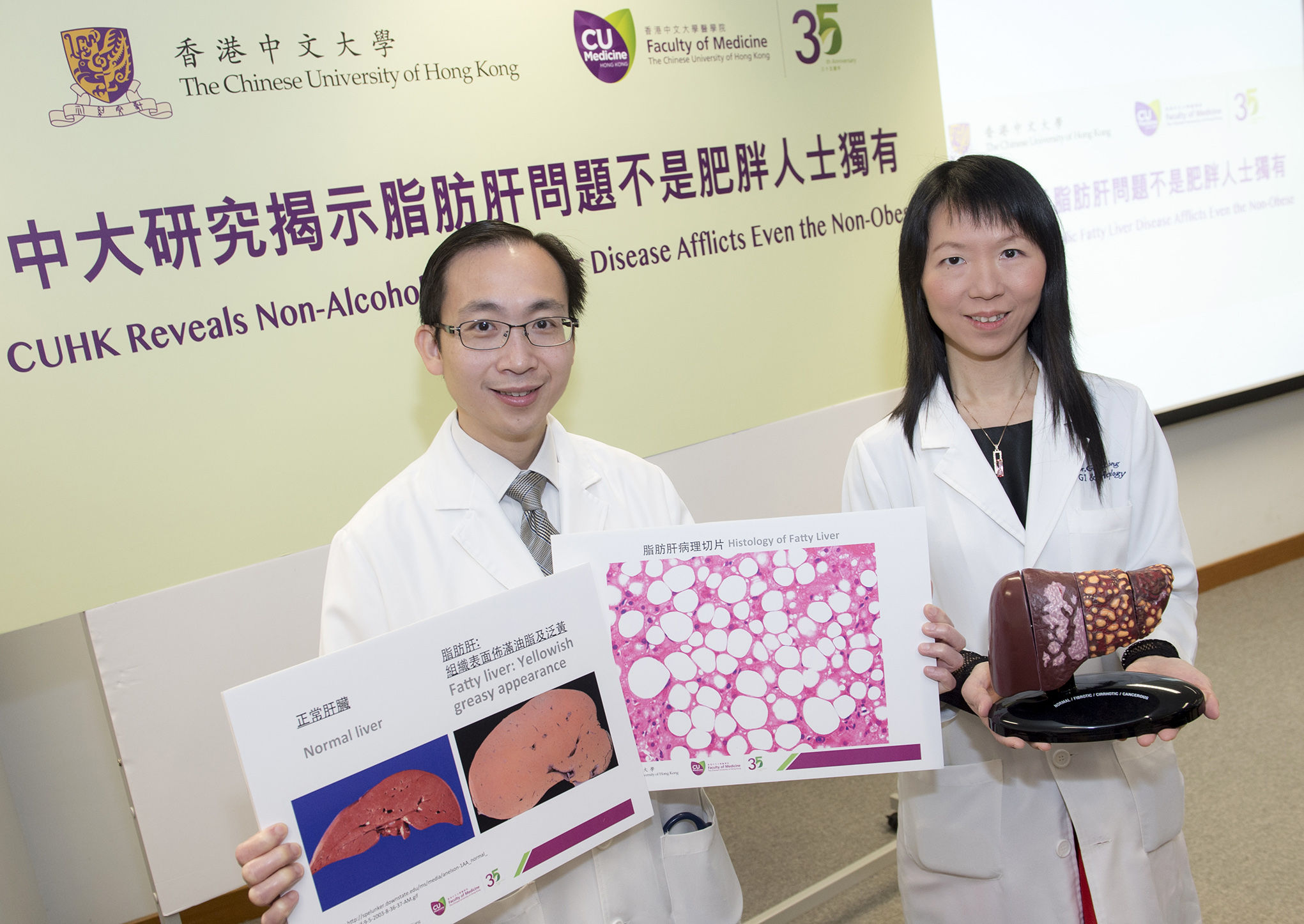 Studies conducted by CUHK Faculty of Medicine reveal that 1 out of 5 non-obese subjects suffer from non-alcoholic fatty liver disease. Some cases may even develop severe liver fibrosis. (Left) Prof. Vincent WONG and Prof. Grace WONG, Division of Gastroenterology and Hepatology, Department of Medicine and Therapeutics. 