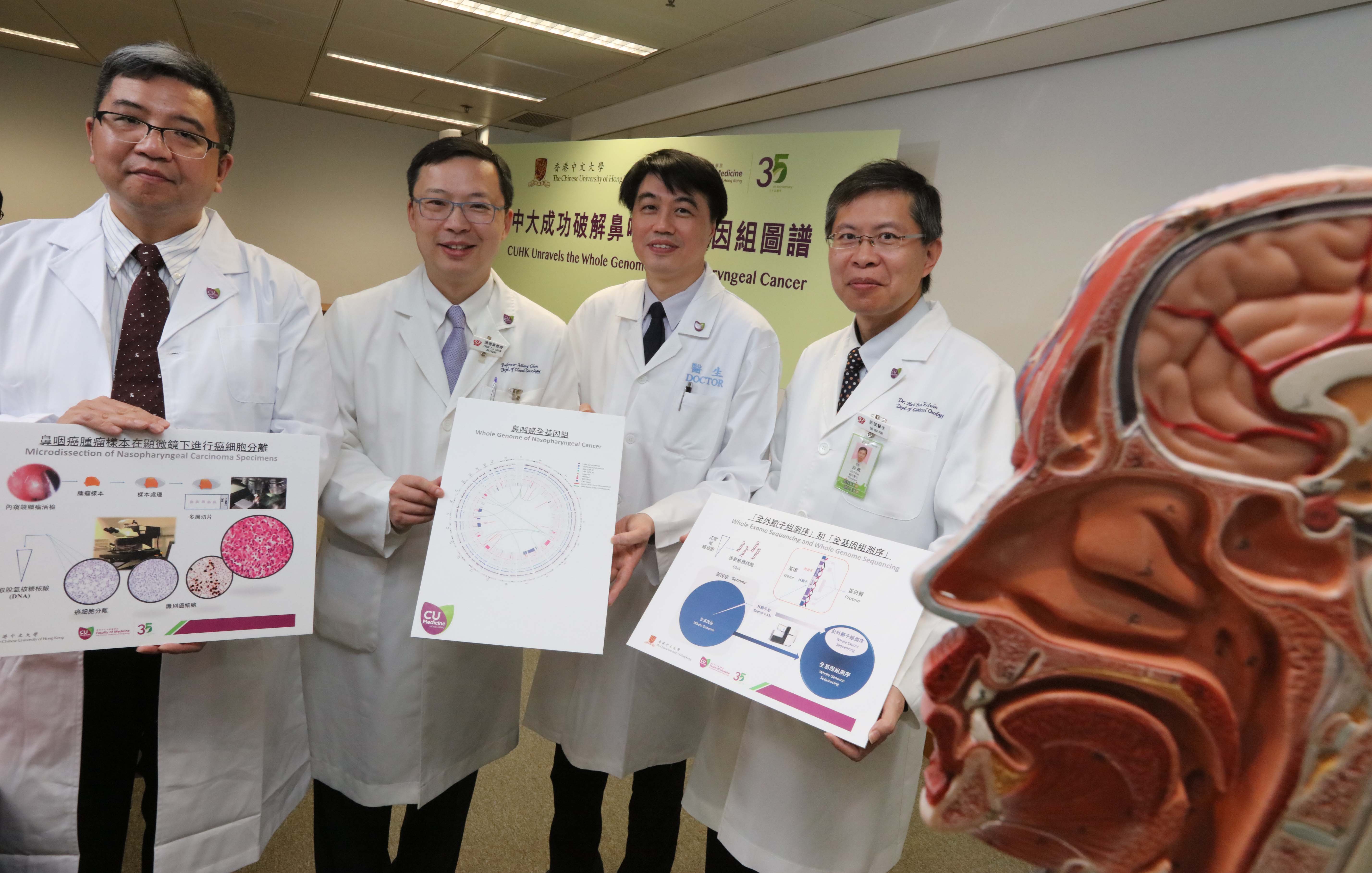 CUHK research team conducted a systematic study to unravel the whole genome of nasopharyngeal carcinoma. The groundbreaking findings will facilitate the development of personalized medicine. (From left) Prof. LO Kwok Wai, Department of Anatomical and Cellular Pathology, Faculty of Medicine; Prof. Anthony CHAN, Li Shu Fan Medical Foundation Professor of Clinical Oncology at CUHK; Prof. TO Ka Fai, Chairman of the Department of Anatomical and Cellular Pathology, Faculty of Medicine; and Dr. HUI Pun, Clinical Associate Professor (honorary), Department of Clinical Oncology, Faculty of Medicine. 