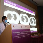 CUHK Research Team Develops an AI System for Detecting COVID-19 Infections in CT with a Privacy Preserving Multinational Validation Study