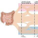 CU Medicine study shows distinct gut microbial profile associated with long COVID