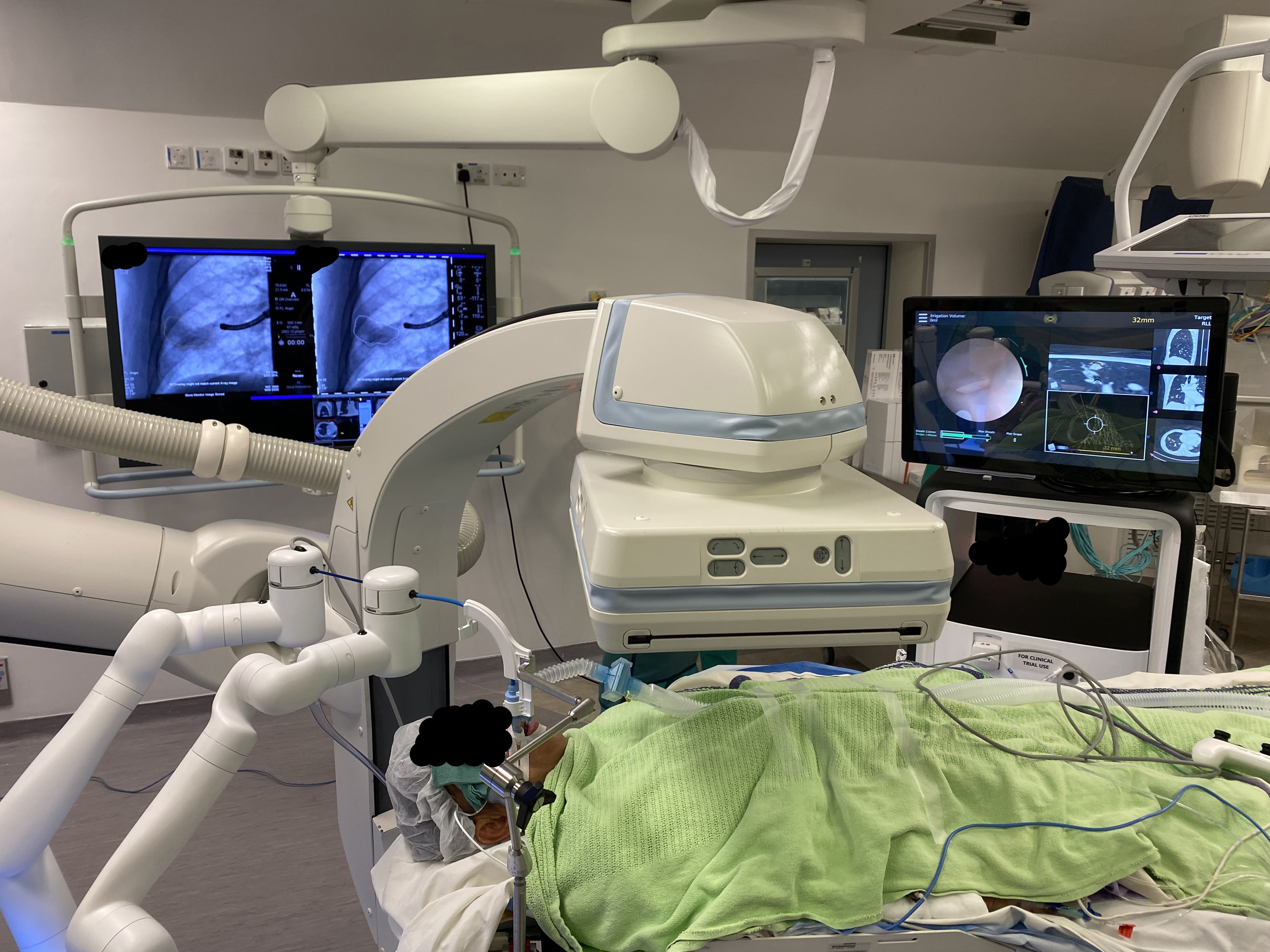 robotic-assisted bronchoscopy