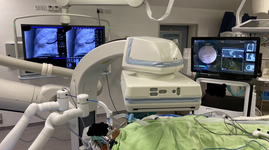 中大成功完成混合手術室機械人輔助支氣管鏡檢查手術 美國以外首例