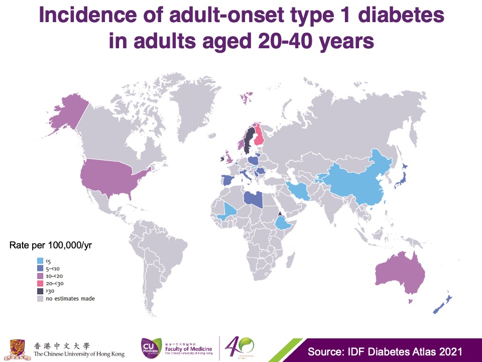 Global pattern of type 1 diabetes incidence in adults