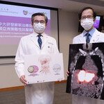 CUHK leading Asia’s battle to improve bile duct cancer survival rates by developing a novel combinational strategy in clinical trial