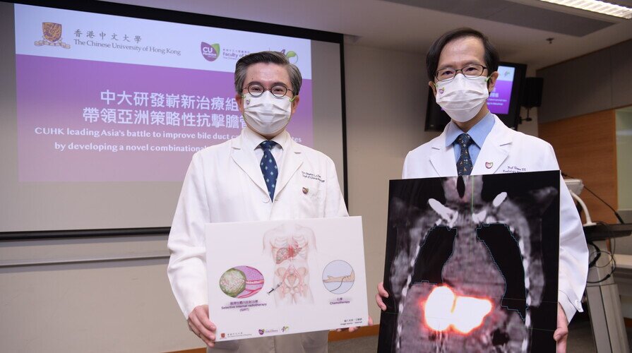 中大研发崭新治疗组合 带领亚洲策略性抗击胆管癌