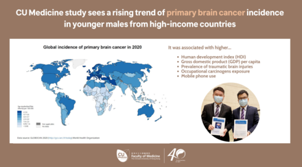 中大发现原发性脑癌的年轻男性发病率上升 以高收入国家的升幅较为显著