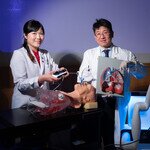 CUHK performs world’s first robotic-assisted bronchoscopic  microwave ablation of lung metastases