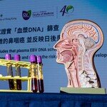 中大研究证实「血浆DNA」筛查能侦测到早期没有病徵的鼻咽癌 并反映日后患鼻咽癌风险