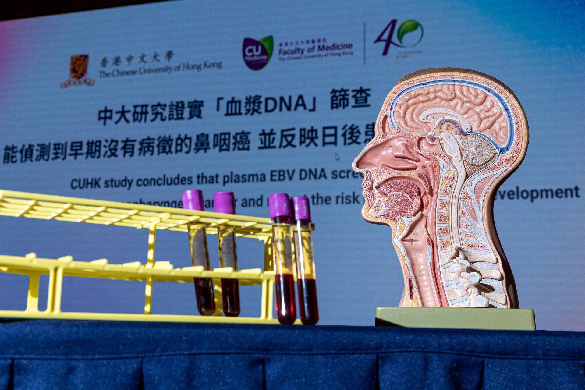CUHK study concludes that plasma EBV DNA screening can detect early asymptomatic nasopharyngeal cancer and reflect the risk of future cancer development 