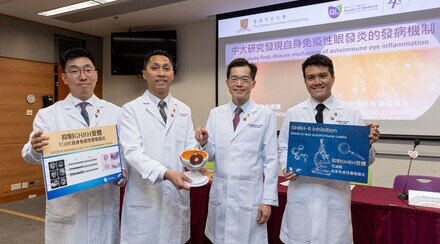 CUHK study opens up a new treatment direction for autoimmune eye inflammation 