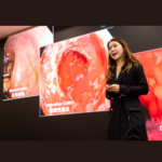 CUHK study shows 1 in 1,000 Hong Kong people will have inflammatory bowel disease in the next decade Annual healthcare costs will exceed HK$400 million by 2034