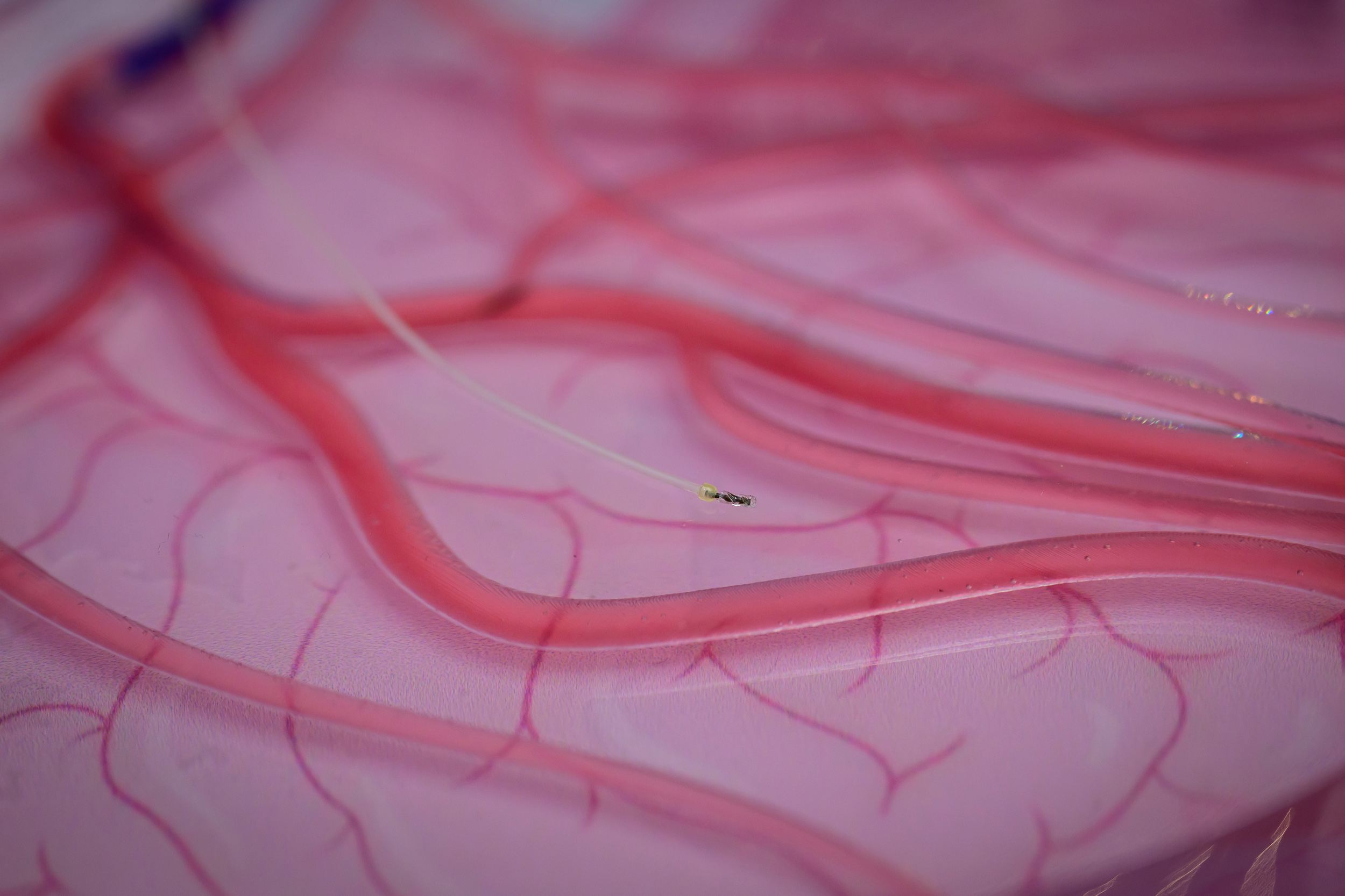 Microcatheter for vascular pathways