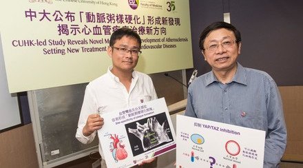 CUHK-led Study Reveals Novel Mechanism for the Development of Atherosclerosis Setting New Treatment Directions to Cardiovascular Diseases