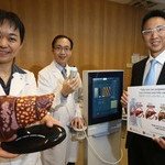 CUHK Discovers Fatty Liver Causing Severe Liver Fibrosis or Cirrhosis in 1 Out of 5 Diabetic Patients