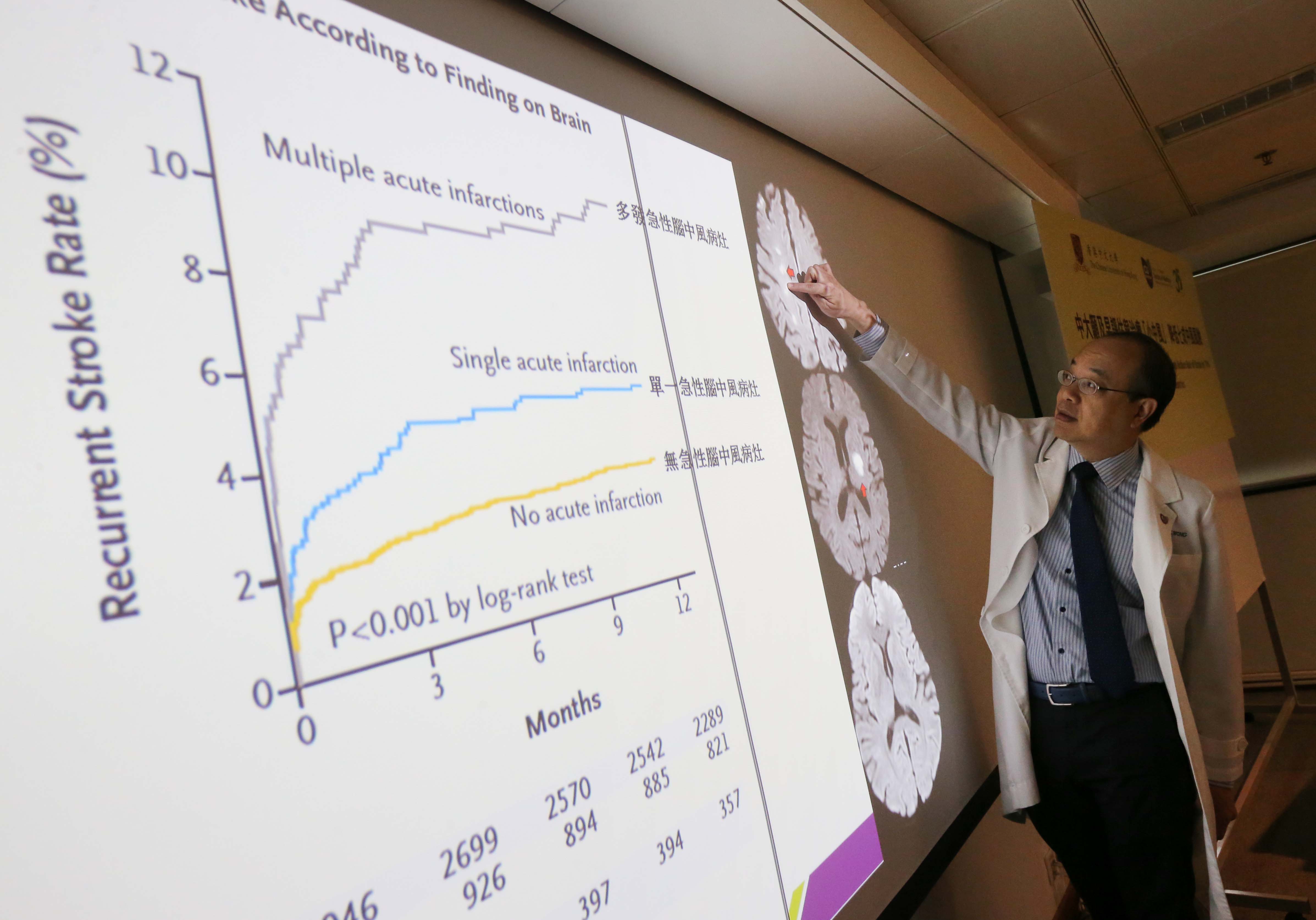 中大医学院内科及药物治疗学系脑神经科主任黄家星教授