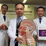 CUHK Research Shows 1 in 5 Throat Cancer Patients in HK is HPV infected