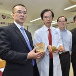 CUHK’s New Prostatic Artery Embolization Shows 90% Success Rate in Relieving Symptoms of Benign Prostatic Hyperplasia