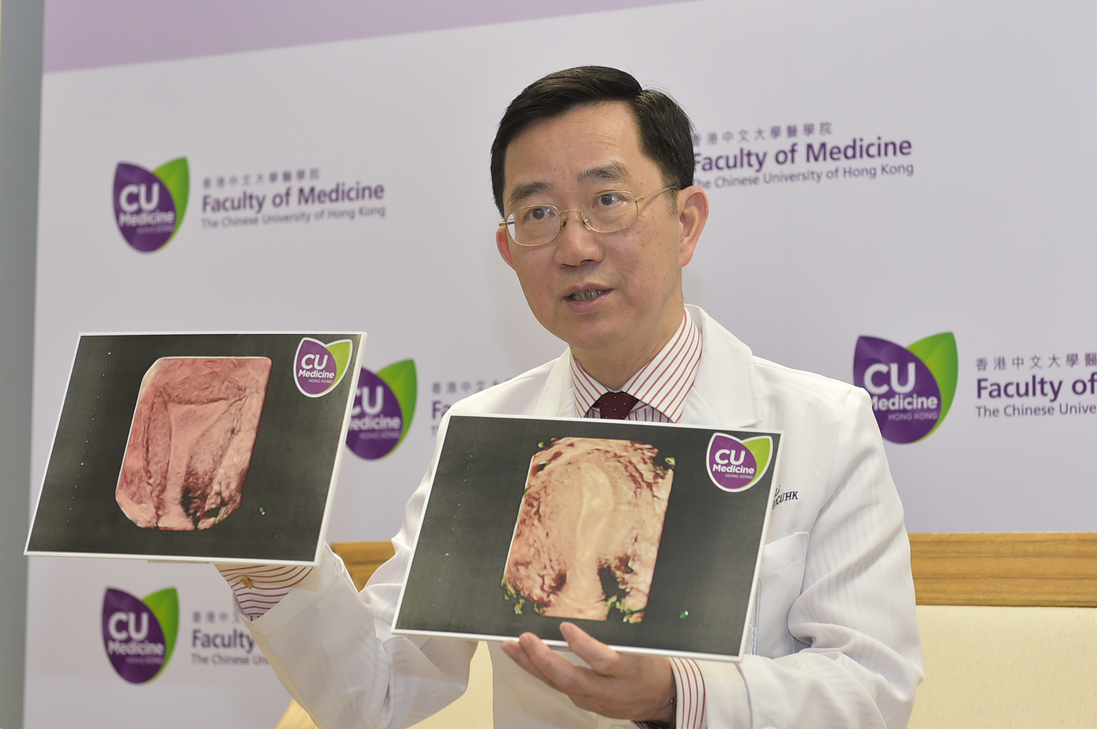 Prof. Li shares his experience and visions on recurrent miscarriage