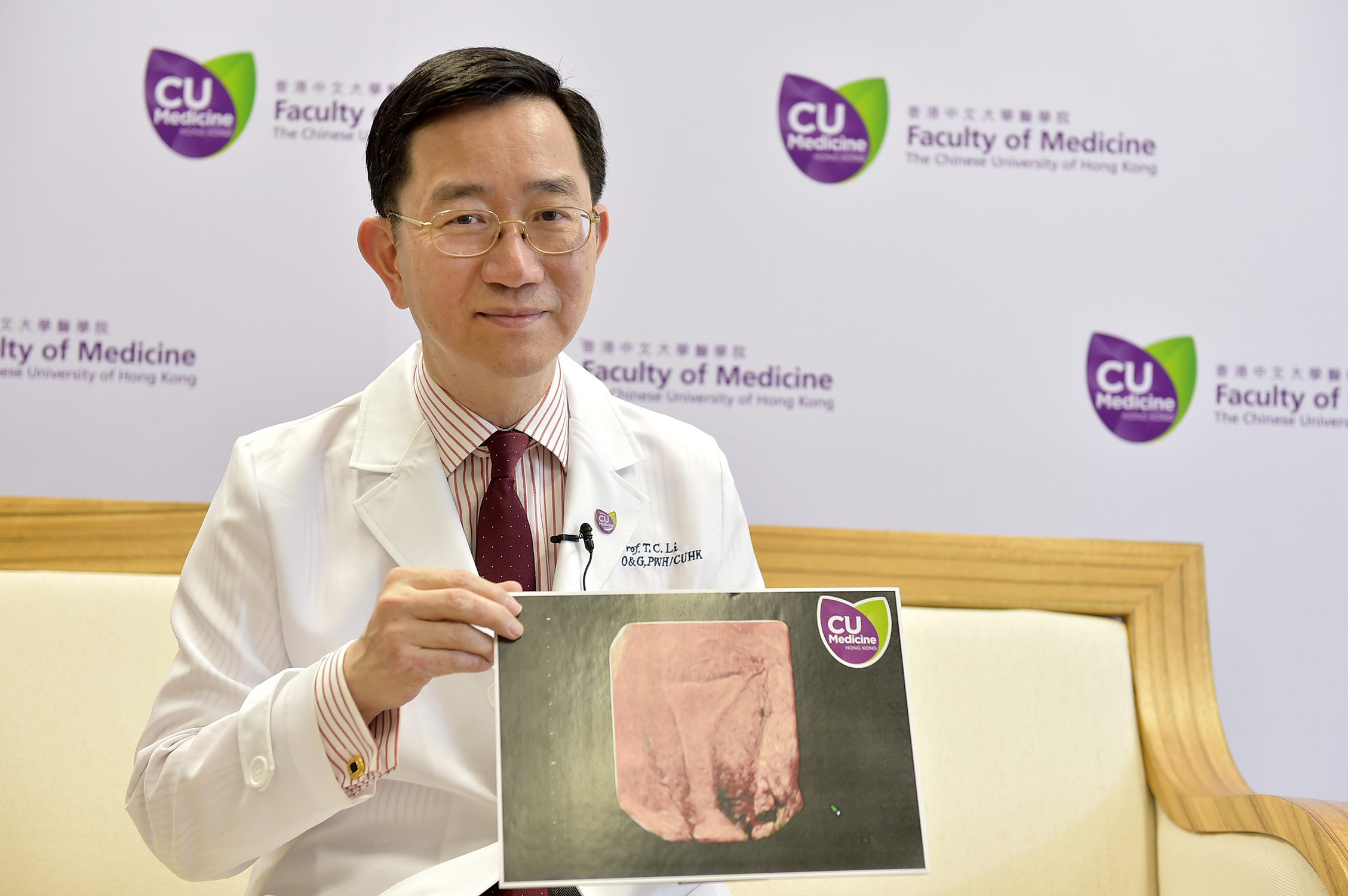 中大醫學院婦產科學系李天照教授是國際人工受孕權威