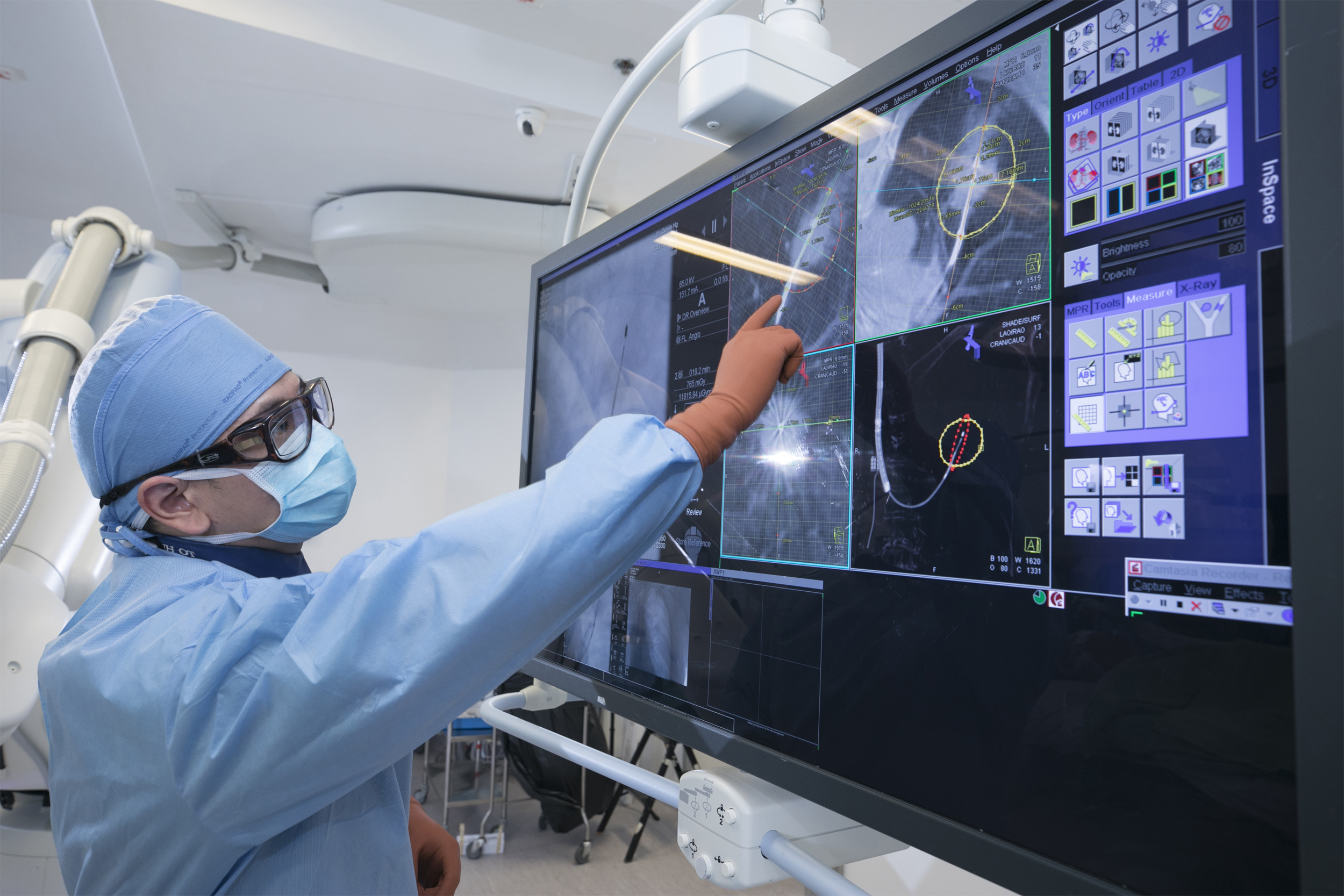 The actual scene showing BMA of lung tumours in the hybrid operating room. The photo shows the confirmation of adequate ablation of cancer cells through advanced evaluation of CT images.