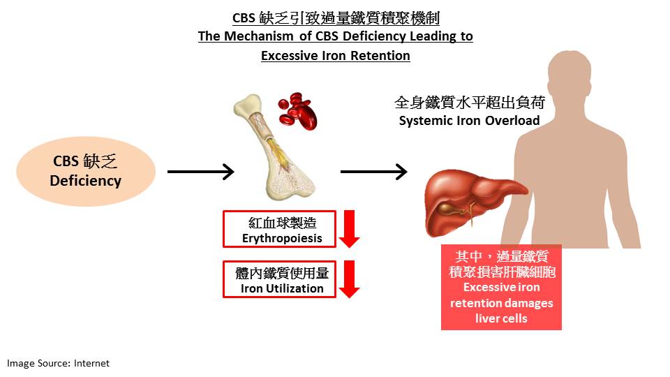 The mechanism of CBS deficiency leading to excessive iron retention